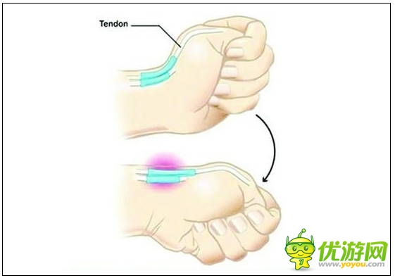 玩手機(jī)易患十大“智能手機(jī)病” 這些癥狀你都有嗎？
